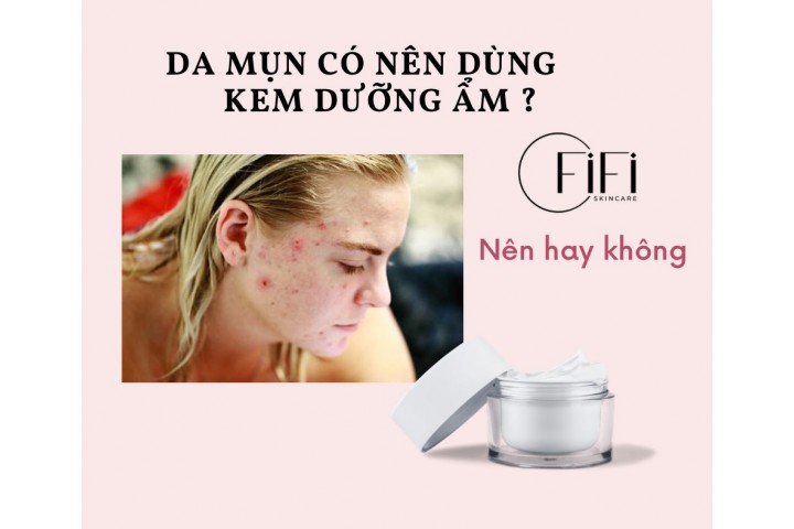 Da mụn có nên dùng kem dưỡng ẩm