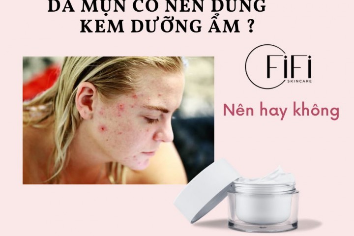 Da mụn có nên dùng kem dưỡng ẩm