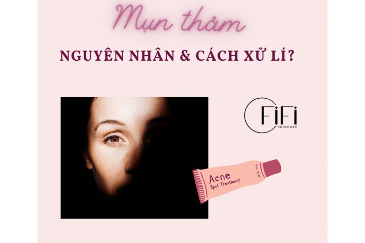 Mụn thâm nguyên nhân xuất hiện và cách xử lí?