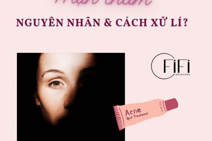 Mụn thâm nguyên nhân xuất hiện và cách xử lí?