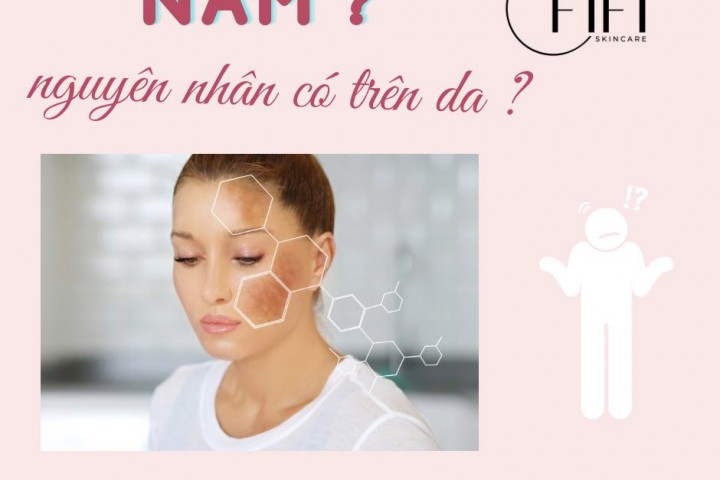 Nám và nguyên nhân xuất hiện