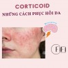 Những cách phục hồi làn da nhiễm Corticoid