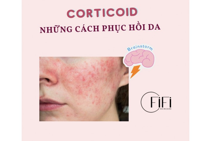 Những cách phục hồi làn da nhiễm Corticoid