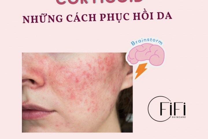 Những cách phục hồi làn da nhiễm Corticoid