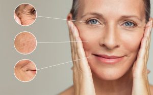 Cải thiện sức khỏe làn da - Collagen dành cho tuổi 40